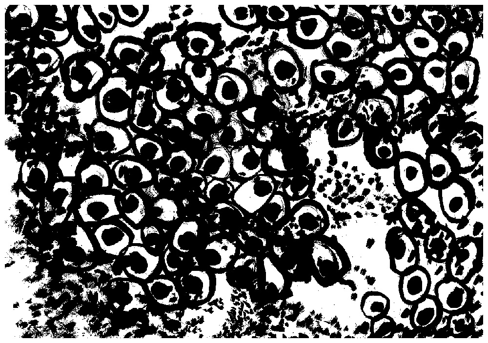 dense ink drawing of cells.